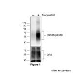Phospho-DP2 Prostanoid Receptor (Ser338, Ser339) Polyclonal Antibody