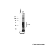TP, TP Thromboxane Receptor Antibody in Western Blot (WB)