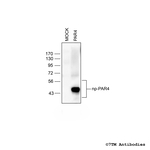 PAR4, Proteinase-Activated Receptor 4 Antibody in Western Blot (WB)
