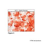 SST1, Somatostatin Receptor 1 Antibody in Immunohistochemistry (Paraffin) (IHC (P))
