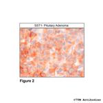 SST1, Somatostatin Receptor 1 Antibody in Immunohistochemistry (Paraffin) (IHC (P))