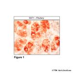 SST1, Somatostatin Receptor 1 Polyclonal Antibody