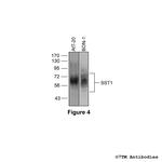 SST1, Somatostatin Receptor 1 Antibody in Western Blot (WB)