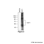 SST1, Somatostatin Receptor 1 Antibody in Western Blot (WB)