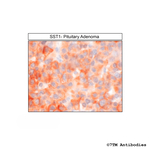 SST1 (Somatostatin Receptor 1) Antibody in Immunohistochemistry (Paraffin) (IHC (P))