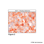 SST1 (Somatostatin Receptor 1) Antibody in Immunohistochemistry (Paraffin) (IHC (P))