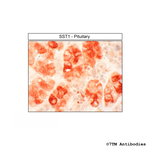 SST1 (Somatostatin Receptor 1) Antibody in Immunohistochemistry (Paraffin) (IHC (P))