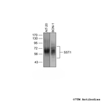 SST1 (Somatostatin Receptor 1) Antibody in Western Blot (WB)