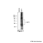 SST1 (Somatostatin Receptor 1) Antibody in Western Blot (WB)