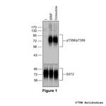 Phospho-Somatostatin Receptor 2 (Thr356, Thr359) Polyclonal Antibody