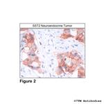 SST2, Somatostatin Receptor 2 Antibody in Immunohistochemistry (Paraffin) (IHC (P))