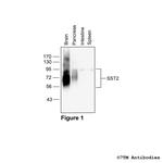 SST2, Somatostatin Receptor 2 Polyclonal Antibody
