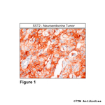 SST2, Somatostatin Receptor 2 Polyclonal Antibody