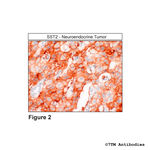 SST2, Somatostatin Receptor 2 Antibody in Immunohistochemistry (Paraffin) (IHC (P))