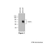 SST2, Somatostatin Receptor 2 Polyclonal Antibody