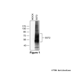 SST2, Somatostatin Receptor 2 Antibody in Western Blot (WB)