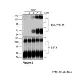 Phospho-Somatostatin Receptor 3 (Ser337, Thr341) Antibody in Western Blot (WB)