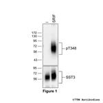 Phospho-Somatostatin Receptor 3 (Thr348) Polyclonal Antibody