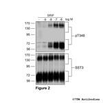 Phospho-Somatostatin Receptor 3 (Thr348) Antibody in Western Blot (WB)
