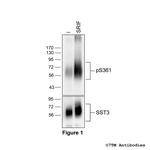 Phospho-Somatostatin Receptor 3 (Ser361) Polyclonal Antibody