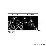 SST3, Somatostatin Receptor 3 Antibody in Immunocytochemistry (ICC/IF)