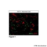 SST3, Somatostatin Receptor 3 Polyclonal Antibody