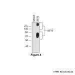 SST3, Somatostatin Receptor 3 Antibody in Western Blot (WB)