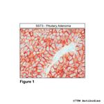 SST3, Somatostatin Receptor 3 Polyclonal Antibody