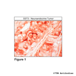 SST3, Somatostatin Receptor 3 Polyclonal Antibody