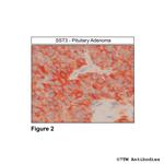 SST3, Somatostatin Receptor 3 Antibody in Immunohistochemistry (Paraffin) (IHC (P))