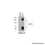 SST3, Somatostatin Receptor 3 Antibody in Western Blot (WB)