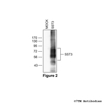 SST3, Somatostatin Receptor 3 Antibody in Western Blot (WB)
