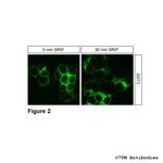 SST3, Somatostatin Receptor 3 Antibody in Immunocytochemistry (ICC/IF)