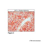 SST3, Somatostatin Receptor 3 Antibody in Immunohistochemistry (PFA fixed) (IHC (PFA))