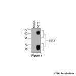 SST3, Somatostatin Receptor 3 Polyclonal Antibody