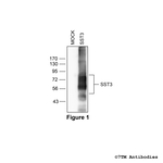 SST3, Somatostatin Receptor 3 Antibody in Western Blot (WB)