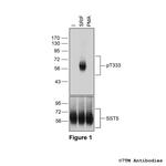 Phospho-Somatostatin Receptor 5 (Thr333) Polyclonal Antibody