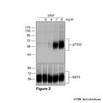 Phospho-Somatostatin Receptor 5 (Thr333) Antibody in Western Blot (WB)