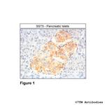 SST5, Somatostatin Receptor 5 Polyclonal Antibody