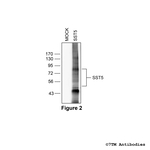 SST5, Somatostatin Receptor 5 Antibody in Western Blot (WB)