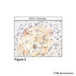 SST5, Somatostatin Receptor 5 Polyclonal Antibody