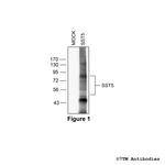 SST5, Somatostatin Receptor 5 Antibody in Western Blot (WB)