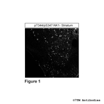 Phospho-NK1, Tachykinin Receptor 1 (Thr344, Ser347) Antibody in Immunohistochemistry (Paraffin) (IHC (P))