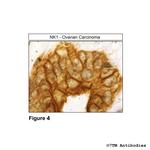 NK1, Tachykinin Receptor 1 Antibody in Immunohistochemistry (Paraffin) (IHC (P))
