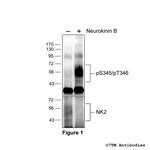 Phospho-Tachykinin Receptor 2 (Ser345, Thr346) Polyclonal Antibody