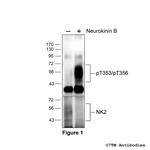 Phospho-Tachykinin Receptor 2 (Thr353, Thr356) Polyclonal Antibody