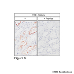V1B, Vasopressin Receptor 1B Polyclonal Antibody