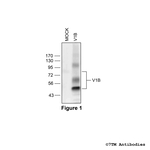 V1B, Vasopressin Receptor 1B Antibody in Western Blot (WB)