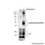 Phospho-Vasopressin Receptor 2 (Ser362, Ser363, Ser364) Polyclonal Antibody