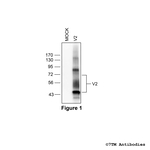 V2, Vasopressin Receptor 2 Polyclonal Antibody